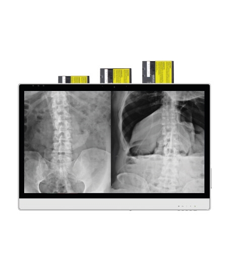 DT-724-medizinischer-Monitor-Akkuzellen-Batterien-antimikrobiell-ST